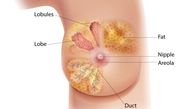 Cancers of the Breast